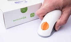 Sydney, Australia - 2022-07-31 CGM - Continuous glucose monitoring: Dexcom g6 sensor for Type 1 diabetes