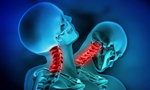 Neurosurgeons flag whiplash legal "myth”